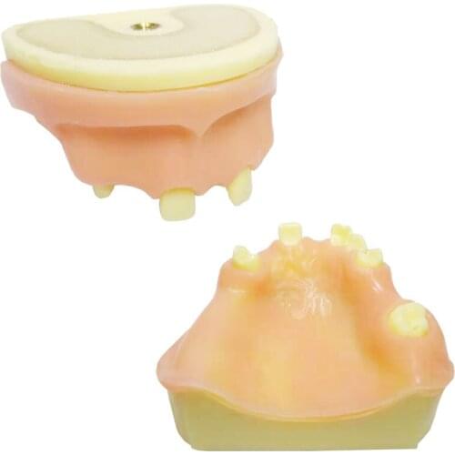 1 Piece Dental Sinus Lift Practice Teeth Model with Imitation Bone (Drilling) & Silicone Soft Gum (Cutting/Stitching)