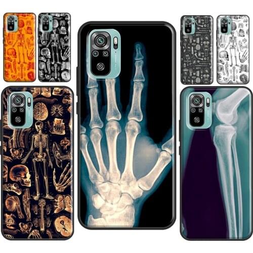X-Ray Human Anatomy For Xiaomi Redmi Note 10 9 Pro 7 8T 9S Note 8 Pro Case For Redmi 9A 9 9C 9T K40 Coque