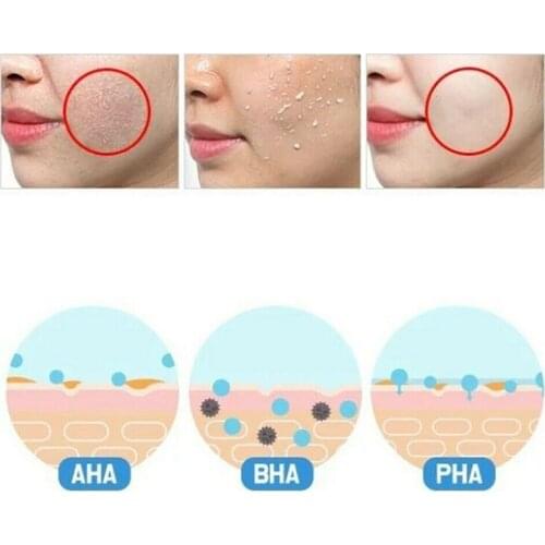 Women Acne Pore Minimizers Exfoliator Facial Peeling Gel Gentle 100g Moisturizing ZGOOD
