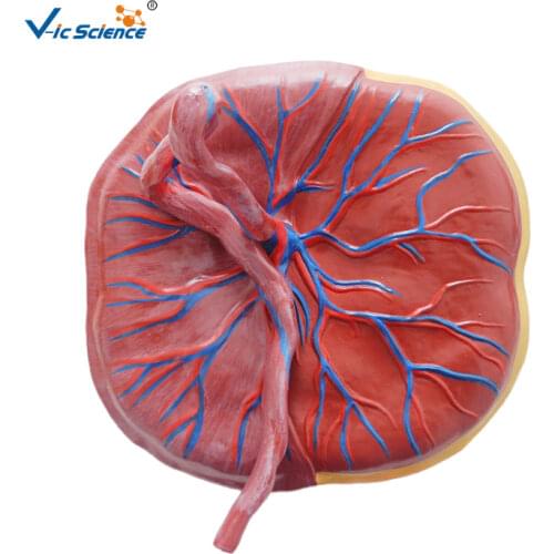 Medical Education Advance Placenta Anatomy Model