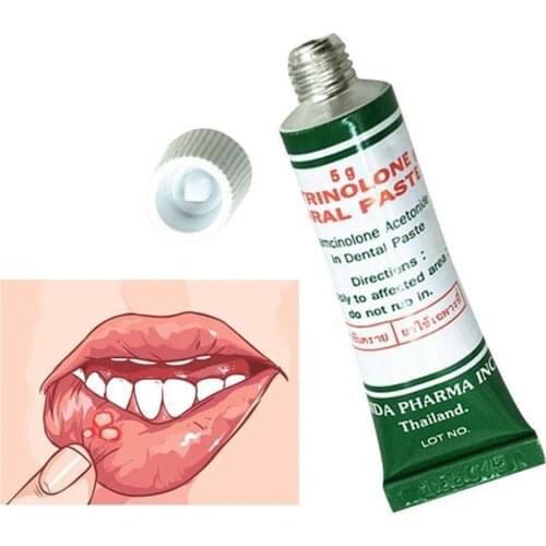 Mouth Ulcer Relief Gel Natural Herbal Oral Hygiene Cream Pain Bad Severe Irritation Antibacterial Breath Inflammation K9M1