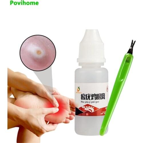 1Set Skin Tag Remover + Pedicure Scraper Removal Mole & Genital Wart Foot Corn Wart Treatment Papillomas Removal Liquid Against