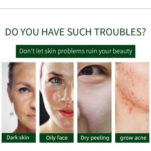 Aloe Vera Gel Soothing Moisturizing Hydrating Skin Calming Skin after Sunburn Organic Aloe Gel for Face Body Soft and gentle2021