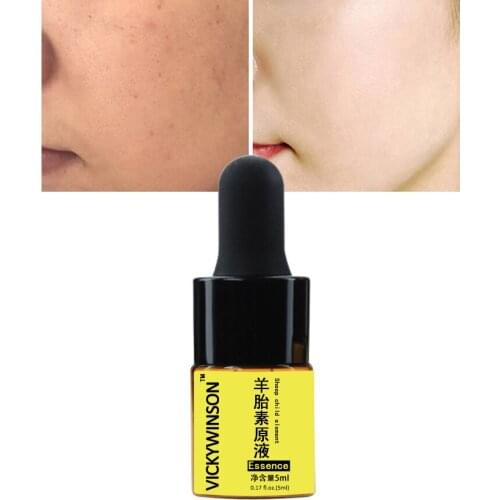 Sheep child element essence 5ml Sheep Placenta Protein Essence Lasting Moisturizing Hydrating Lighten Fine Lines Facial Serum