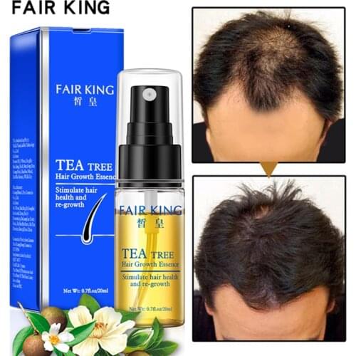 Tea Tree Hair Growth Essence Prevent Hair Loss Product Elastic Hair Oil Anti Lose Hair Make Hair Smoother Nourishing Hair Care