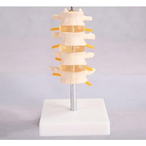 Four Sections Normal Lumbar Vertebrae Combination Human Spine Anatomical Model BIX-A1017