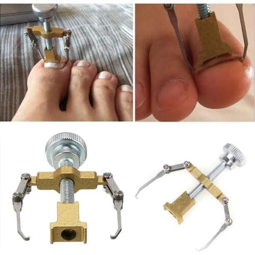 Paronychia Ingrown Toenail Correction Tool Pedicure Foot Toe Nail Care Treatment Straightening Clip Brace Corrector Fixer
