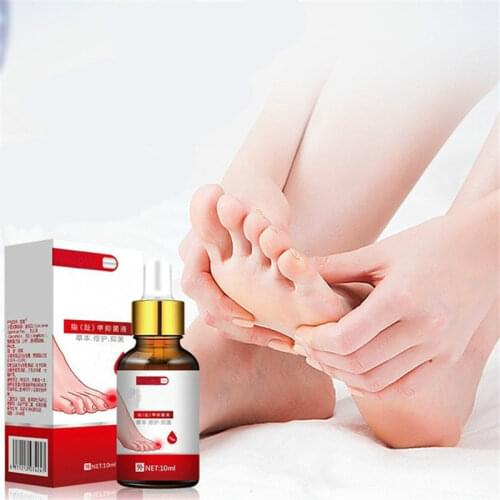 Nail Fungal Treatment Feet Care Essence Nail Foot Whitening Toe Nail Fungus Removal Gel Anti Infection Paronychia Onychomycosis