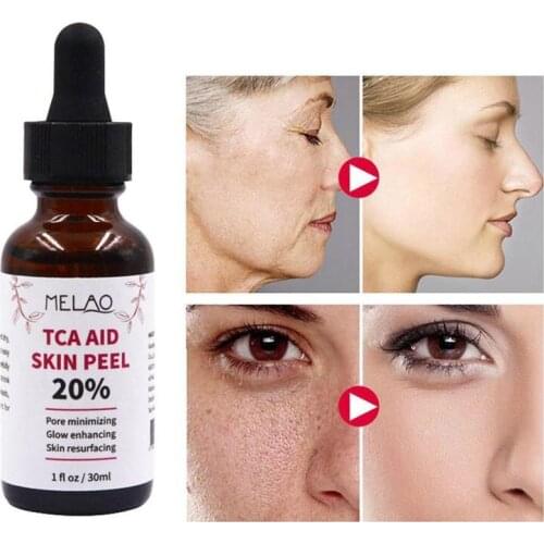 High Quality 20% Skin Peel Pore Minizing Essence Whitening Remove Spot Essence Shrink Pores Anti-acne Regenerative Face Serum