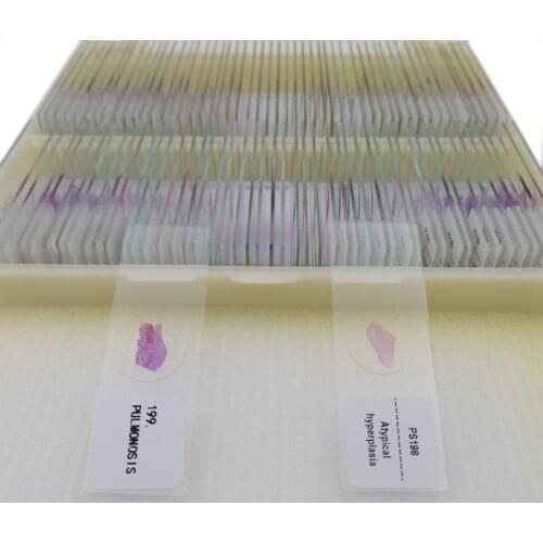 100Pcs Microscope Human Pathology Prepared Slides Set