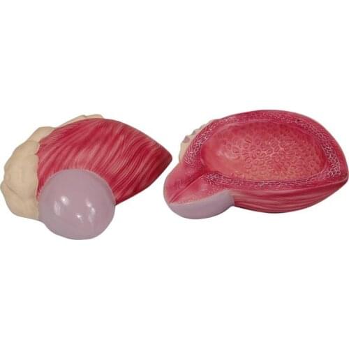 Amplification Medical Human Bladder Model Prostate Model Urogenital System Anatomy Anatomy and Urology of The Urogenital System