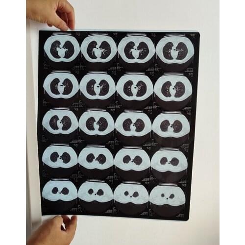 Medical X-Ray film dry film for agfa printer drystar 5302 5503 dt2b dt5b dt10b and Fuji 3500/2000/Liter Printer