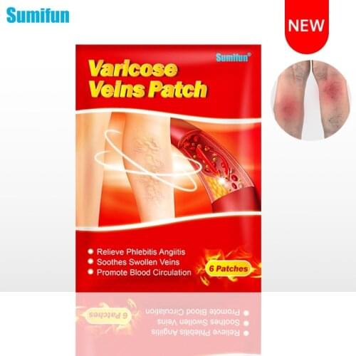 Sumifun 6/12/36pcs Varicose Veins Plaster Vasculitis Phlebitis Spider Leg Skin Care Treatment Medical Patch Angiitis Removal