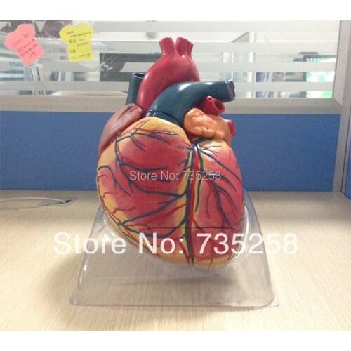 Advanced Cardiac Enlargement Model,Adult Heart Model ,Heart Anatomy Teaching Model