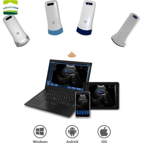 Sonostar WIFI Pig Sonar Scanner Sheep Wireless Veterinary Scanner Portable Pregnancy Test Handheld Ultrasound Machine Pig Farm