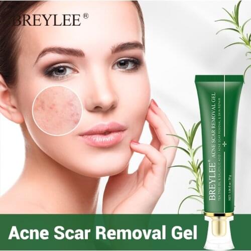 BREYLEE Acne Scar Treatment Cream Removal Gel Fade Acne Marks Spots Remove Skin Pigmentation Whitening Acne Serum Essence 30g