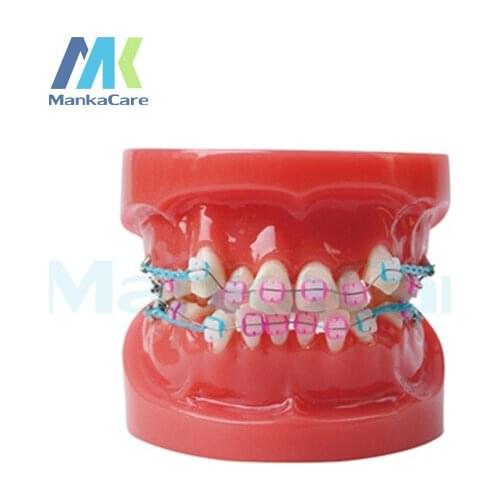Manka Care -24pcs Tooth , all ceramic bracket Oral Model Teeth Tooth Model
