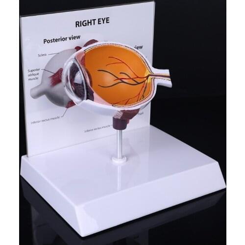 Human Right Eye Eyeball Model Cross Section Anatomical Glaucoma Display Study Teaching Tool H9EB