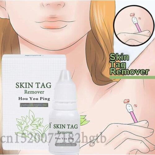 Ultra Strength Skin Tag Remover Foot Corn Treatment Mole Skin Tag Body Warts Remover 10ml
