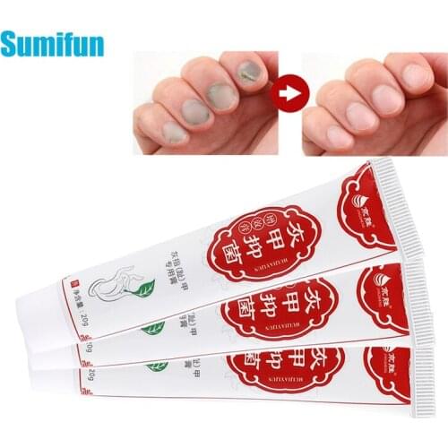 20g Onychomycosis Anti Fungal Cream Natural Herbal Nail Repai Ointment Fingernails Toenail Remove Thick Gray Nail Repair Plaster