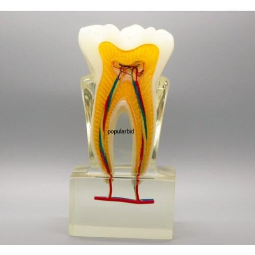 Orthodontic model 6:1 teeth nerve anatomical dissection demonstration Dentist endodontics Teaching with clear base