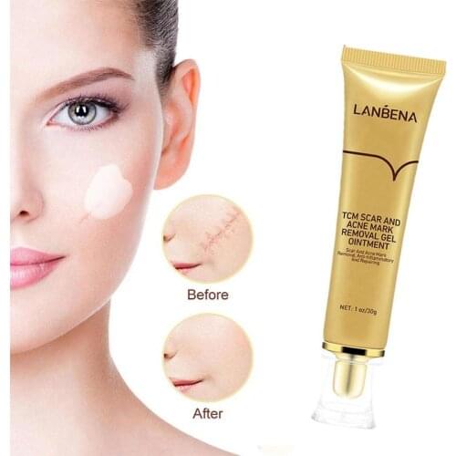TCM SCAR AND ACNE MARK REMOVAL GEL Acne Scar Removal Skin Repair Care Cream Screm Stretch Cosmetics For Face Marks Herbal R X0B6