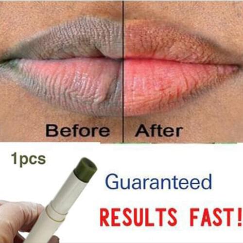 Pink Fresh Lightening Lip Cream Treatment to Remove Dark Lips