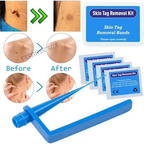 Micro Band Skin Tag Removal Kit Papilloma Removal Set Wart Spot Mole Remover Skin Care Warts Removal Skin Tags Body Effect Band