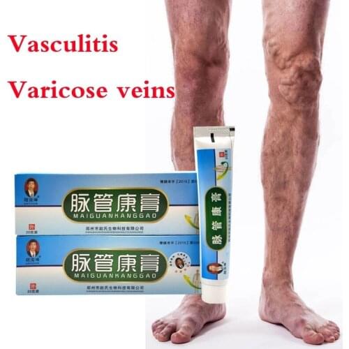 20G Chinese Herbal Medicine Vasculitis Ointment For Varicose Vein Inflammation Massage Ointment For Varicose Veins Ointment