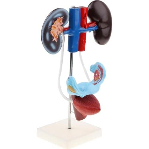 Female Genitourinary System Model Genital Model 4 Parts Kidney, ureter, uterus and accessorie Anatomical Organ medical supplies