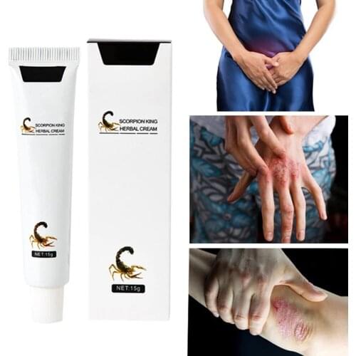 Scorpion Psoriasis Creams Dermatitis Eczema Pruritus Cream Foot Care Body Cream Effective Foot Treatment