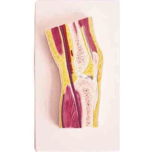 SMD02559 knee joint profile model