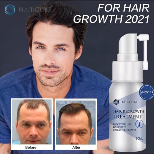 Hair Loss Products and Fast Hair Growth Remedy Essence Oil Natural Extracts Liquid Hair Regrowth Products Treatment Solutions