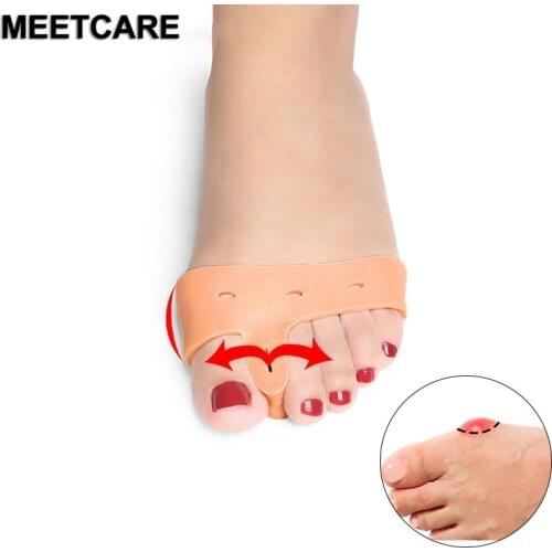 Meetcare Forefoot Silicone Gel Sleeve Hallux Valgus Correction Thumb Orthopedic Braces Big Toe Eversion Crossbow Feet Pain Care