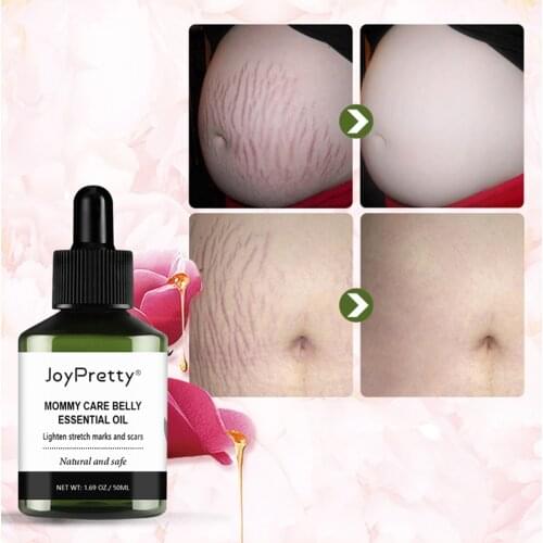 Stretch Marks Remover Essential Oil Skin Care Treatment Cream For Stretch Mark Removal Maternity Slackline For Pregnant Oils
