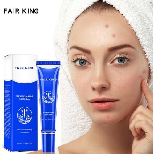 Remova Anti Acne Whitening Face Cream Deep Cleaning Acne Scar Shrink Pores Treatment Facial Skin Care Cream Blackhead Repair