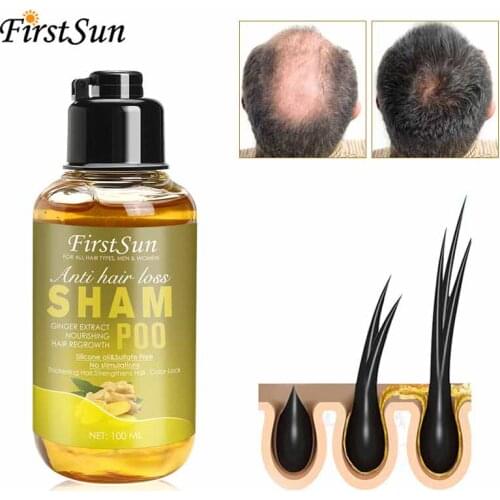 ALIVER Hair Growth Essential Oil Ginseng Preventing Hair Loss Hair Nourisher Serum Repair Damaged Hair Nourishing Scalp Care