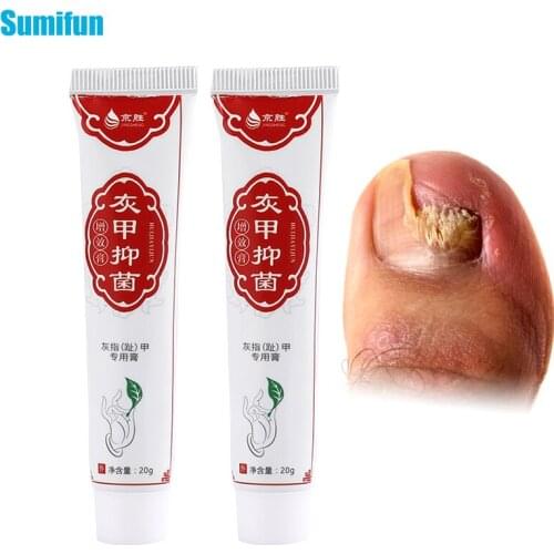 20g Onychomycosis Anti Fungal Cream Natural Herbal Nail Repai Ointment Fingernails Toenail Remove Thick Gray Nail Repair Plaster