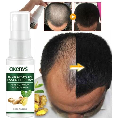 1/2Pcs Hair Growth Spray Fast Grow Hair Hair LossTreatment Preventing Hair Loss 20ml Hair Growth Spray For Man