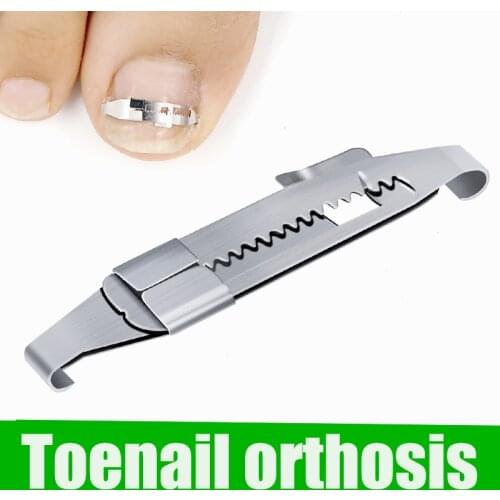 Ingrown Toenails Correction Pedicure Foot toe Nail Care Tools Straightening Clip Brace corrector Nail Correction Tool