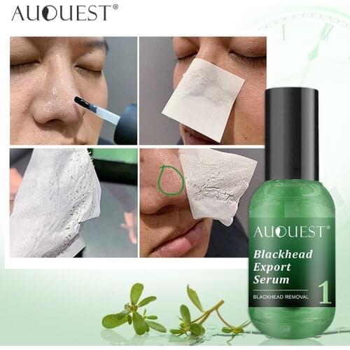 AuQuest Blackhead Export Serum Deep Cleaning Purify Pores Smoothing Skin T Zone Care Oil-Control Shrink Pores Facial Serum 15ml