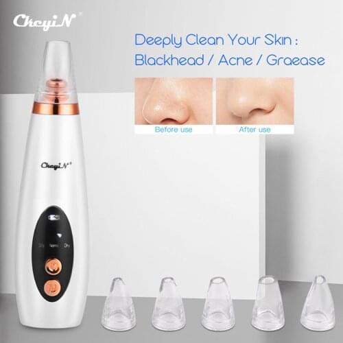 CkeyiN USB Rechargeable Blackhead Remover Face Pore Vacuum Skin Care Acne Pore Cleaner Pimple Removal Vacuum Suction Tools