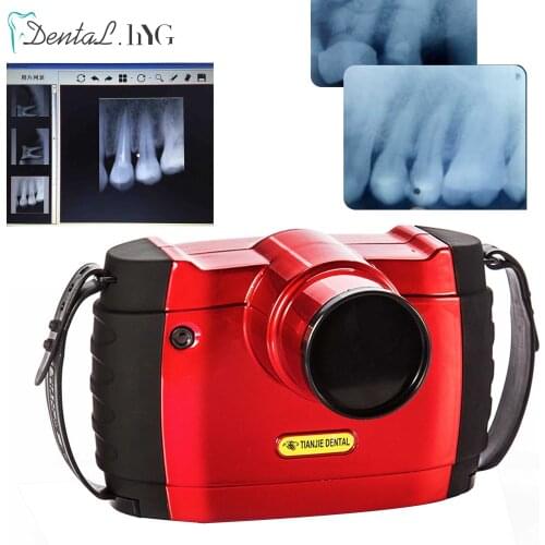 Dental Portable X Ray Machine /High Frequency Portable Dental X-Ray Machine/Dental Imaging System Portable x ray Machine BLX-10