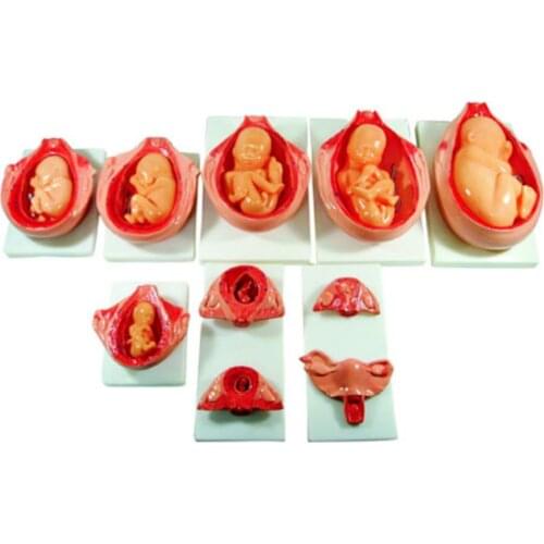 The Development Process for Fetus Medical teaching manikin Patient Nursing skills Training Simulator