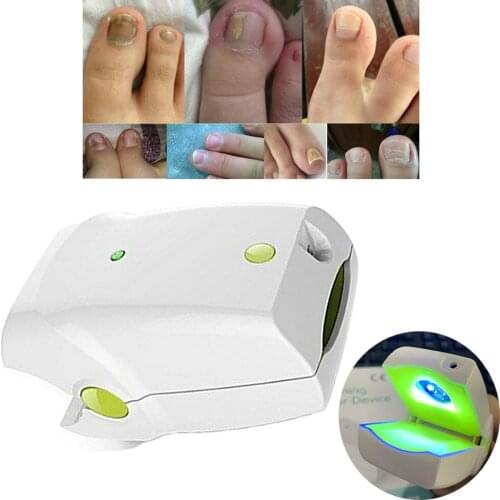 No Pain Rechargeable Nail Fungus Removal Toenail Fungus Soft Laser Therapy Device Fingernails Anti Fungal Infection