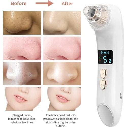 Bubble Blackhead Remover Electric Pore Cleaner Vacuum Suction For Acne Pimple Black Dot Removal Facial Skin Care Beauty Device