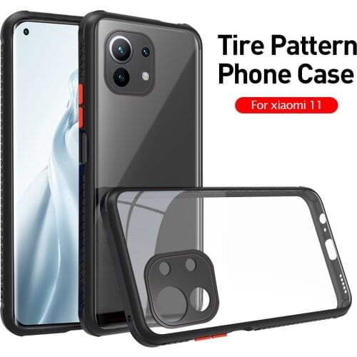 Tire Pattern Clear Case For Xiaomi 11 Lite Mi 11i Camera Protection Bumper Cover Xiomi Mi11 i Light 11Lite Acrylic Back Fundas