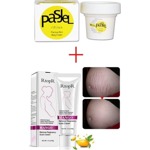 Pasjel And Rtopr Stretch Marks Remover Thailand Maternity Precious Skin Body Cream Effectively Pregnancy Scars Removal Creme