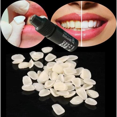 Dental White Adhesive 3ml Teeth Gel Comfort Bond Tooth Veneer Quick Desensitizer Equivalent formula Teeth Whitening Products