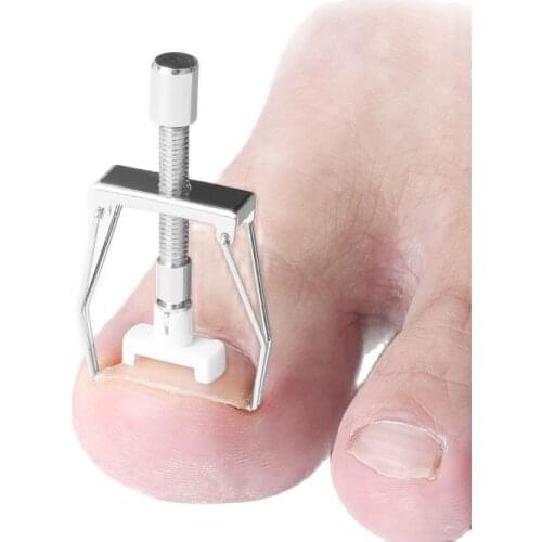 1PC Stainless Steel Ingrown Toe Nail Correction Tool Orthodontic device of paronychia embedded foot Nail products nail set